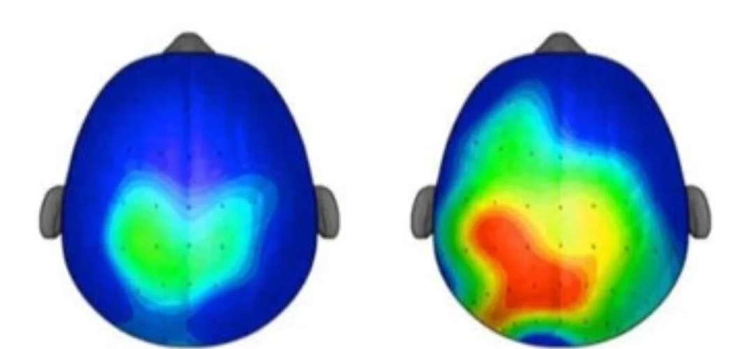 Hersenactiviteit na 20 minuten bewegen versus 20 minuten stilzitten
